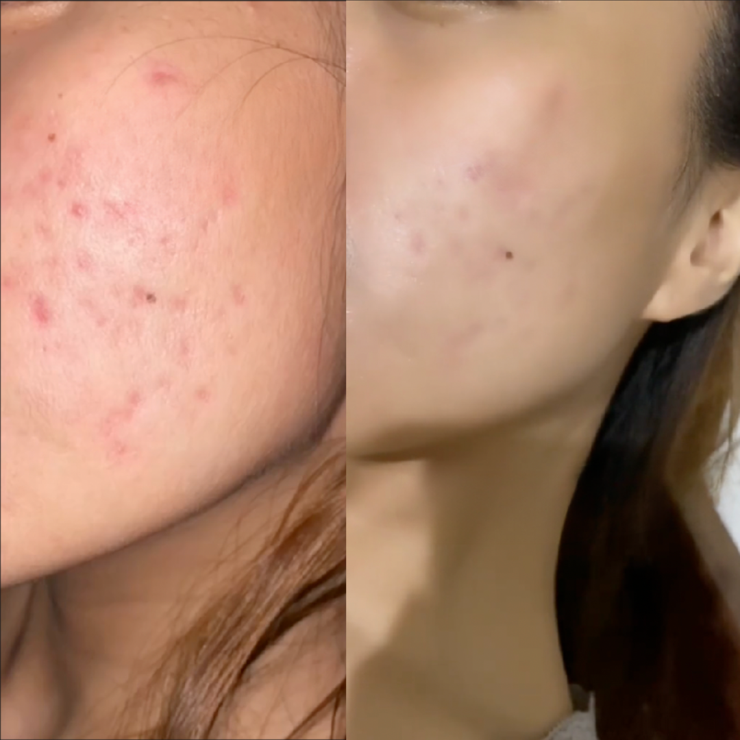 Scar Removal Sheets